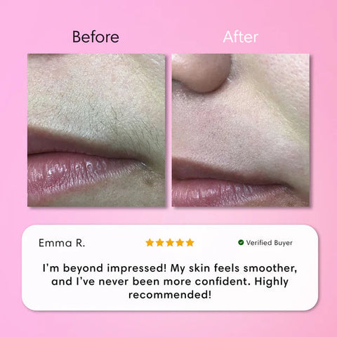 Hair Removal Kit