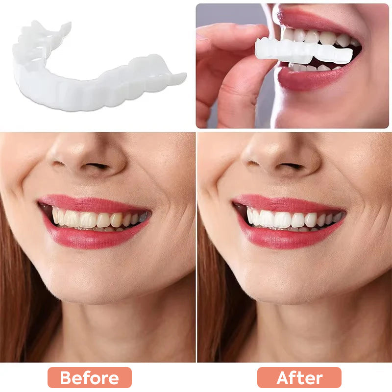 Snap-on Teeth Perfect Smile Cosmetic Teeth Veneers Fake Teeth Top and Bottom for Men and Women