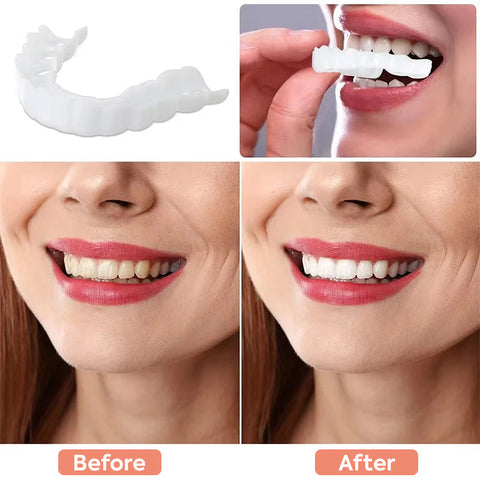 Snap-on Teeth Perfect Smile Cosmetic Teeth Veneers Fake Teeth Top and Bottom for Men and Women