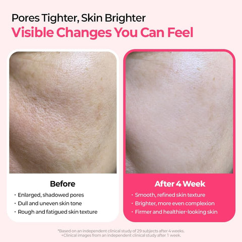 🔥Pore & Spot Care Duo